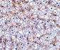 Fn14 Antibody